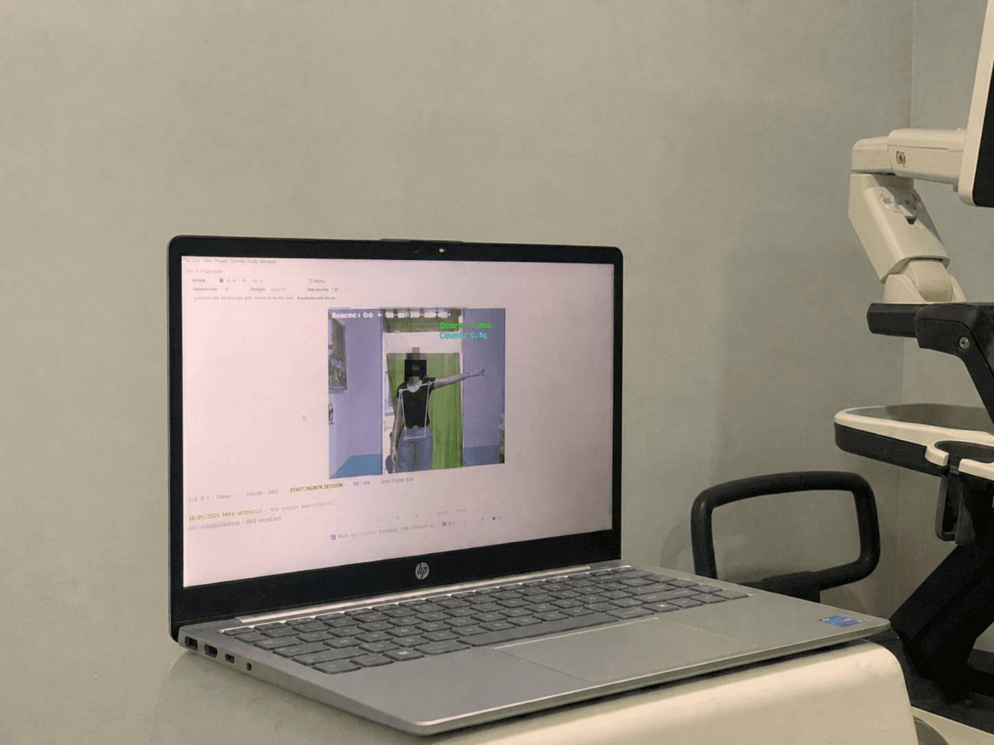 Privacy-edited photograph of the Frozen Shoulder DSS prototype running on ordinary laptop hardware during field testing.