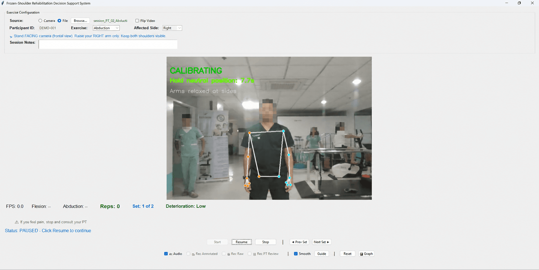 Sanitized Frozen Shoulder DSS interface showing calibration, pose landmarks, exercise selection, and session state.